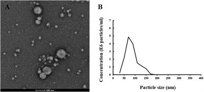 TDP-43 Is Elevated in Plasma Neuronal-Derived Exosomes of Patients With Alzheimer’s Disease